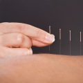 Acupuncture for Genital Herpes Treatment